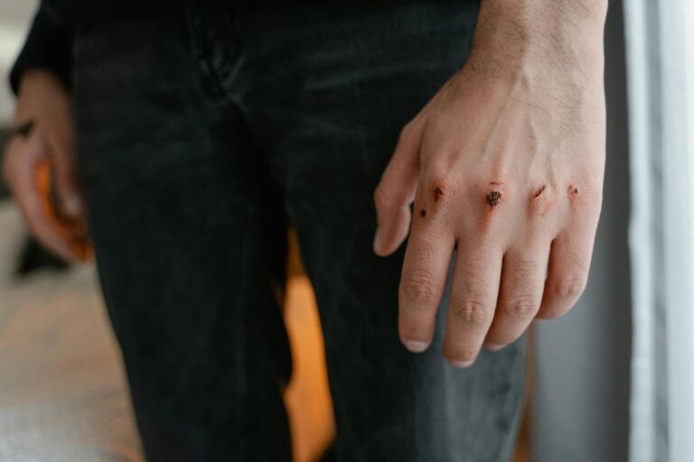 [Bit#13] Blessing or Curse? The People with the “Pain Switch” Turned Off