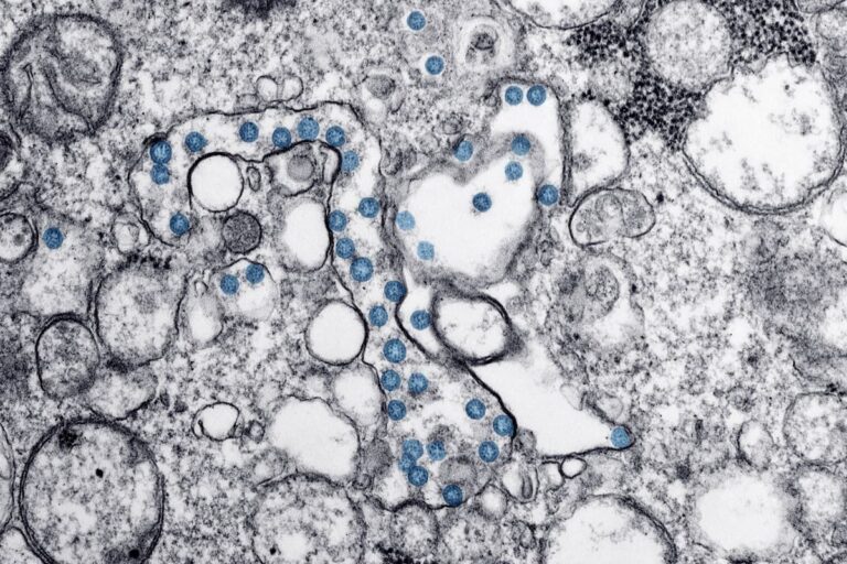 [Bit#66] Cytokine Storm: Why Our Immune System Attacks Itself