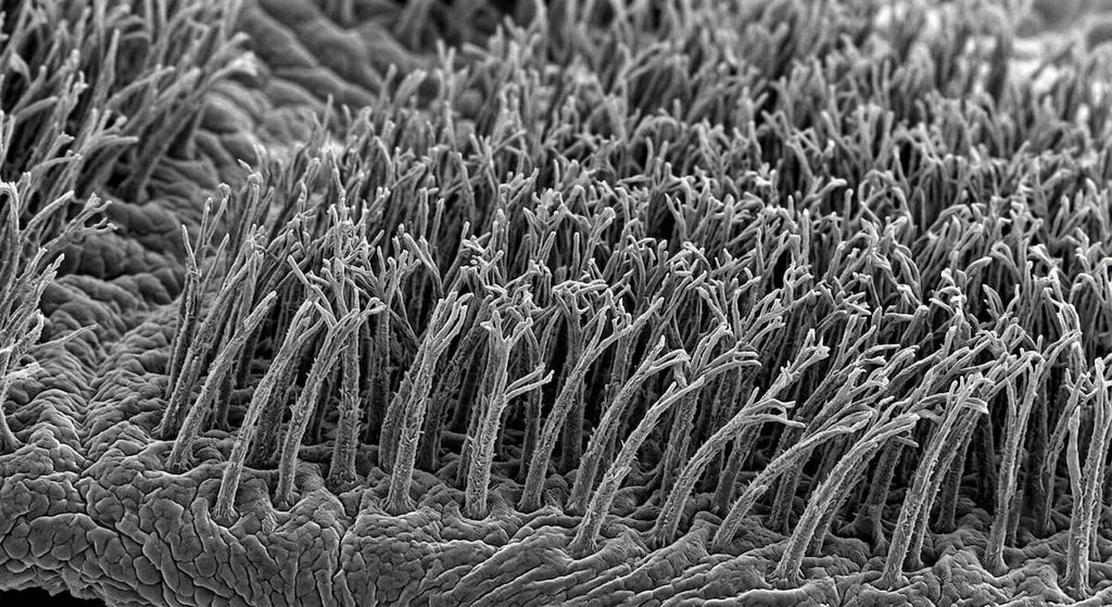 Microscopic setae covering a gecko's toe pad