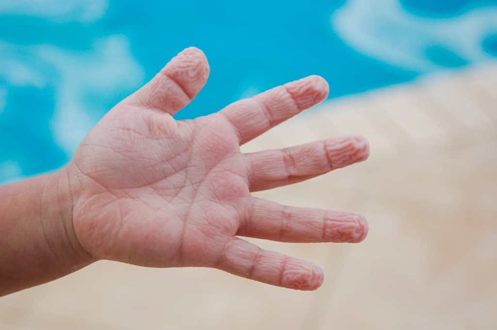 Human fingertips with visible wrinkles after prolonged water exposure